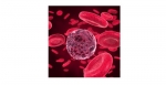 Thrombotic Thrombocytopenic Purpura (TTP)-Hemolytic Uremic Syndrome (HUS)   